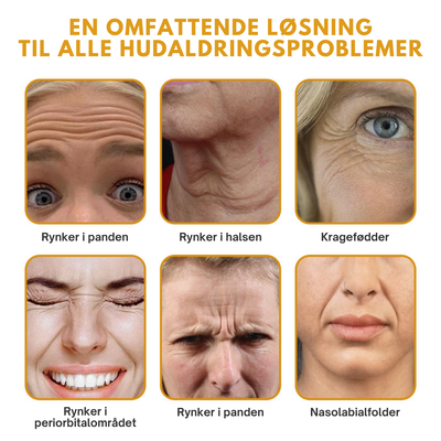 DermaLift™ – Avanceret Botox-Lignende Creme