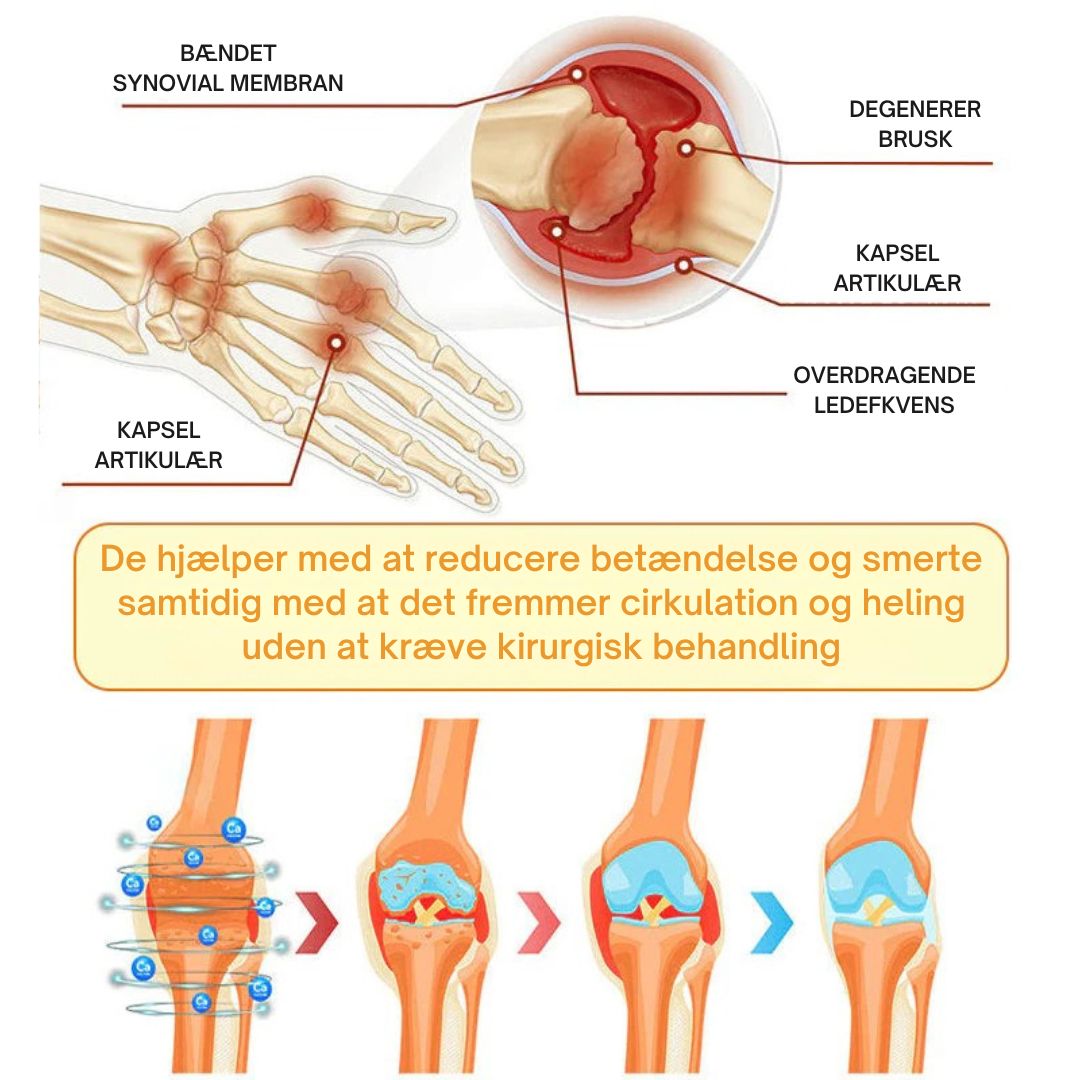 ArthroEase™ – Leddegigt Smertelindrende Spray