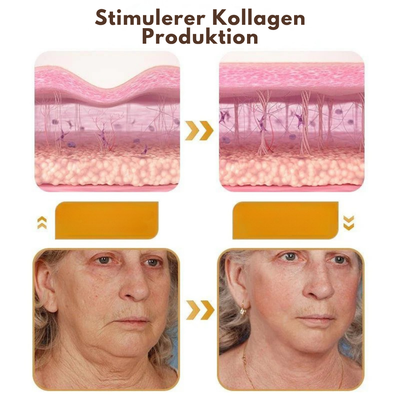 DermaLift™ – Avanceret Botox-Lignende Creme