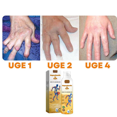 ArthroEase™ – Leddegigt Smertelindrende Spray