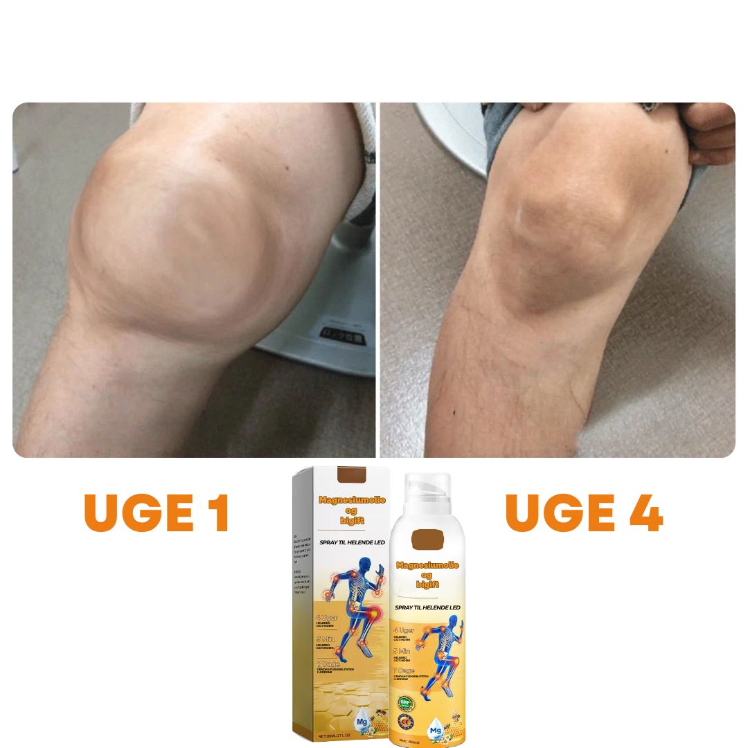 ArthroEase™ – Leddegigt Smertelindrende Spray