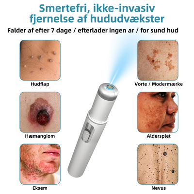 Dermaze™ – Ikke-invasiv laser fjernelse af modermærker