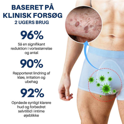 WartAway™ – Genitalvorte Lindre Creme