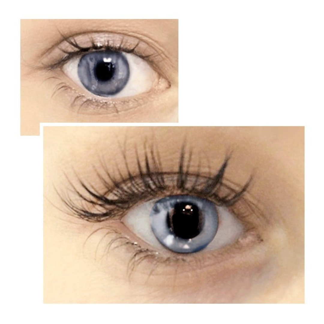 Lashora™ – Avanceret Peptidbaseret Vippeserum