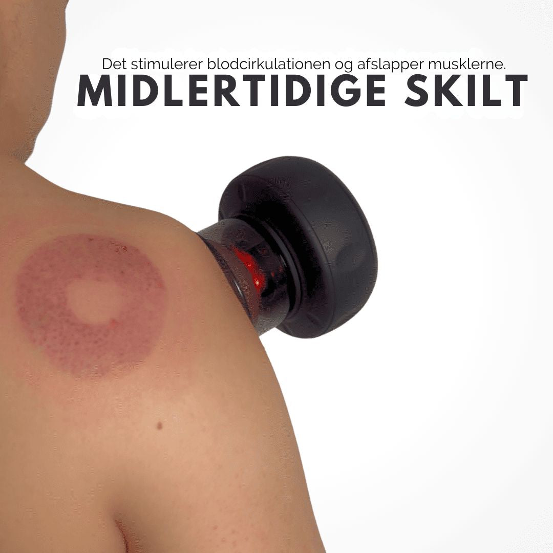 RevivaCup™ – Smart Opvarmet Cupping Massager
