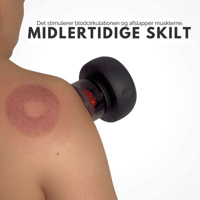 RevivaCup™ – Smart Opvarmet Cupping Massager