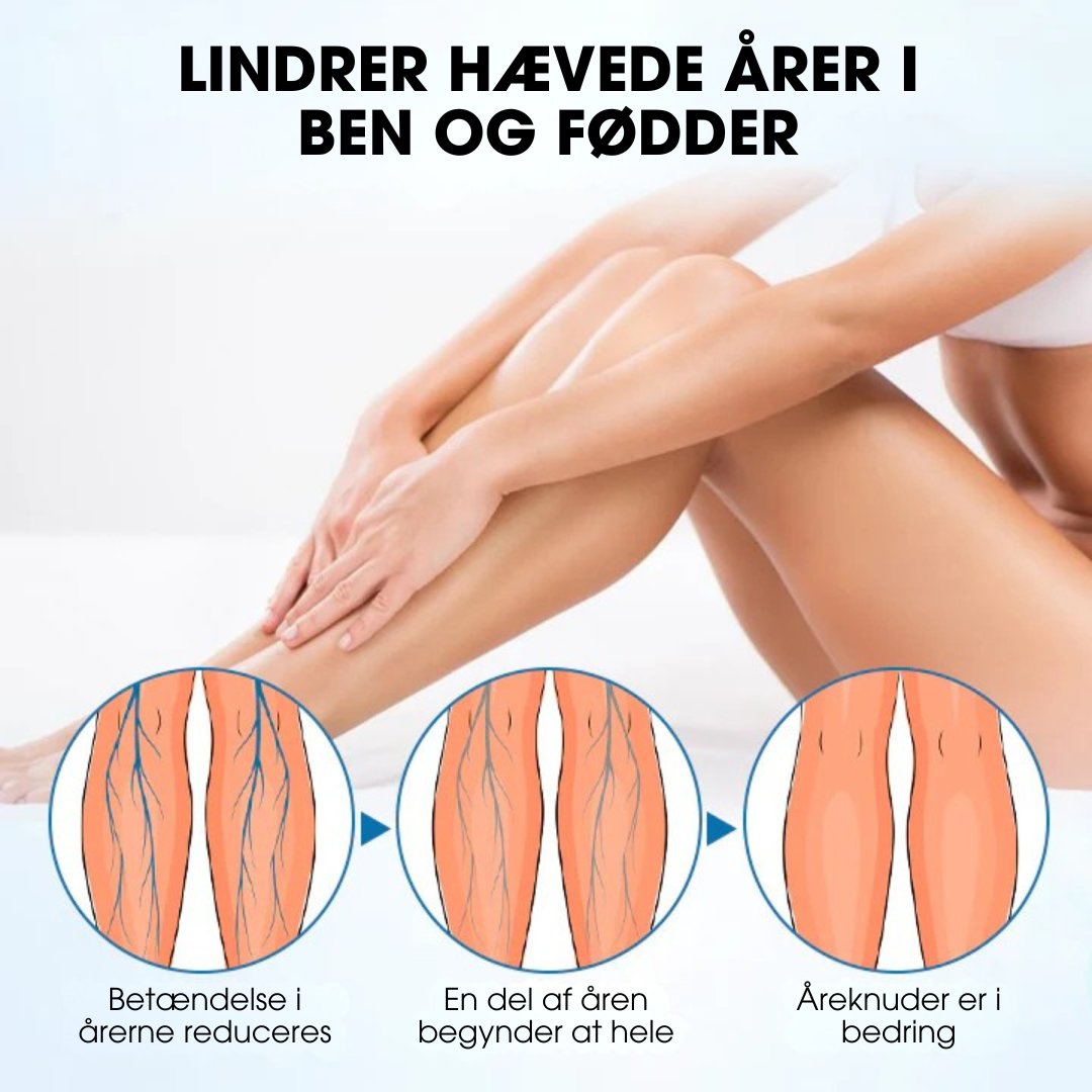Varicell™ – Revolutionerende Varicose Vein Lindring