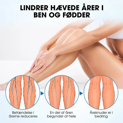 Varicell™ – Revolutionerende Varicose Vein Lindring