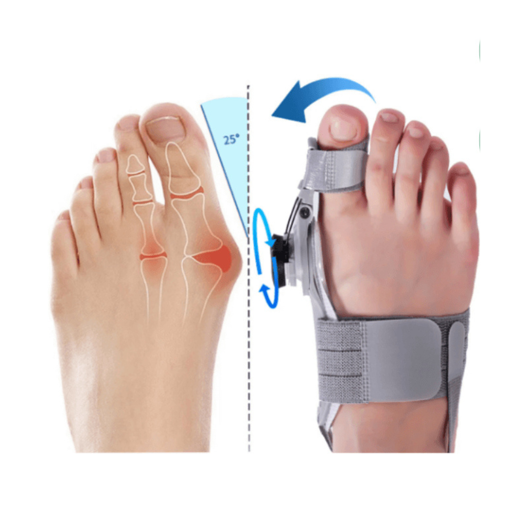 ToeComfort™ – Smertelindring og Korrektur for Hallux Valgus