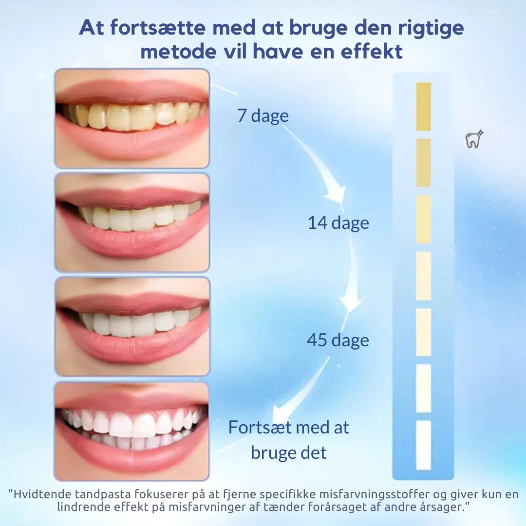 FreshLuxe™ – Niacinamid Whitening & Pletfjernende Tandpasta
