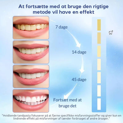 FreshLuxe™ – Niacinamid Whitening & Pletfjernende Tandpasta
