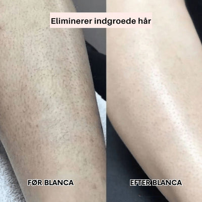 Blanca™ – Dobbelthovedet Præcisionsbarbering