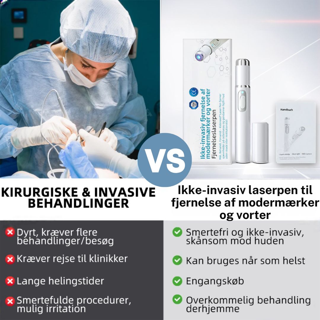 Dermaze™ – Ikke-invasiv laser fjernelse af modermærker