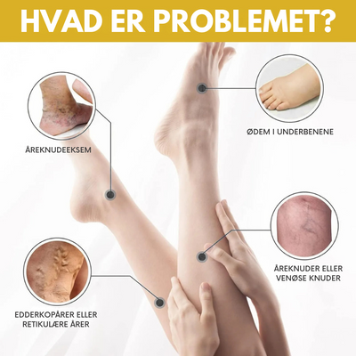 VeinoLux™ – Beroligende creme til ben og vener