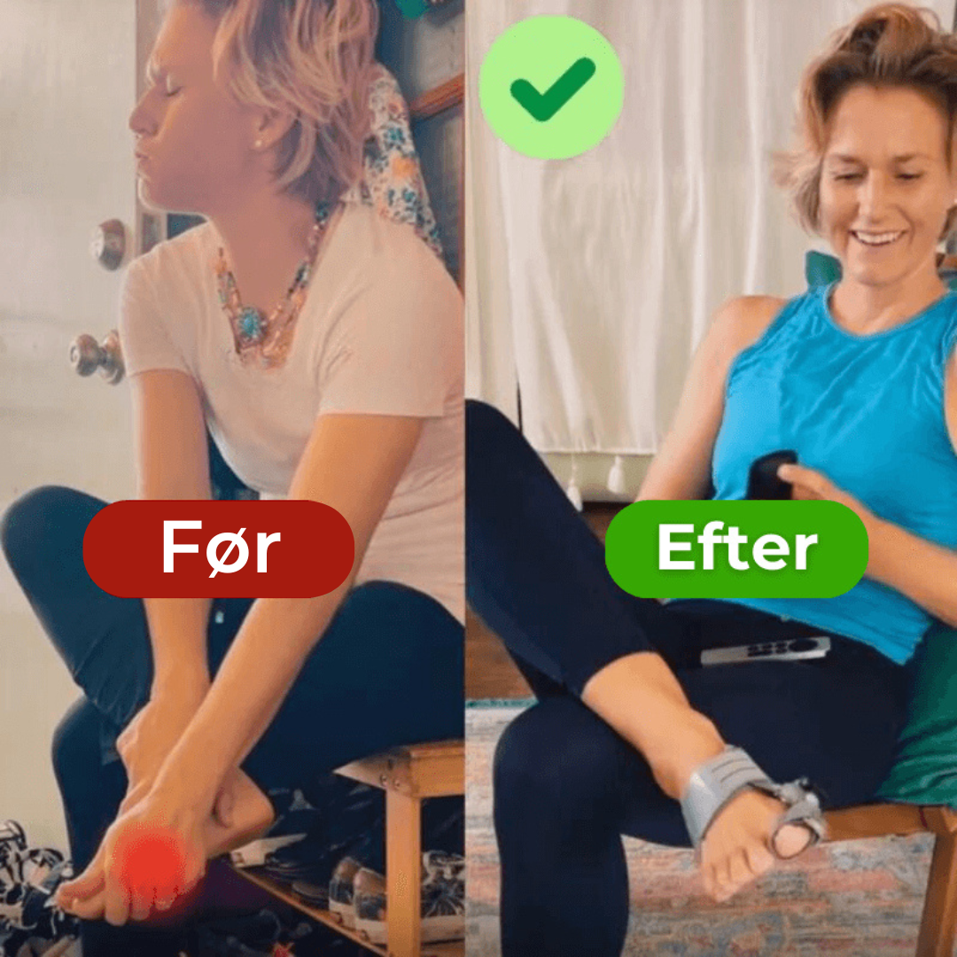 ToeComfort™ – Smertelindring og Korrektur for Hallux Valgus