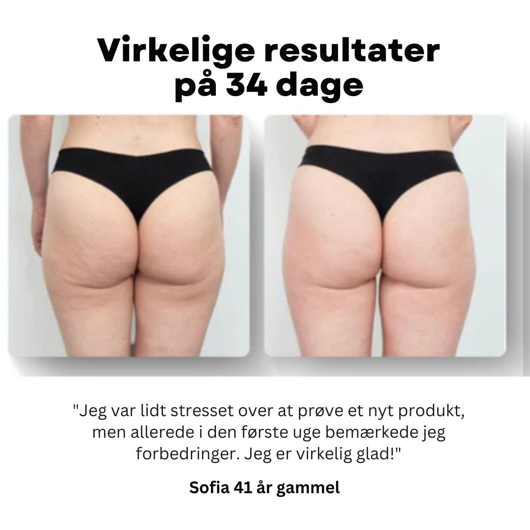 Cellexa™ - Cellulite Reduceringsmassager