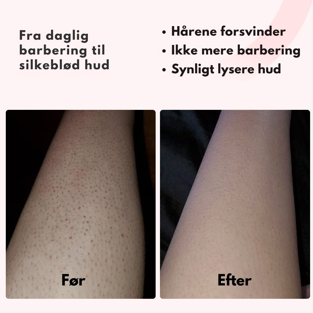 Silkify™ – Smertefri Permanent Hårfjerning