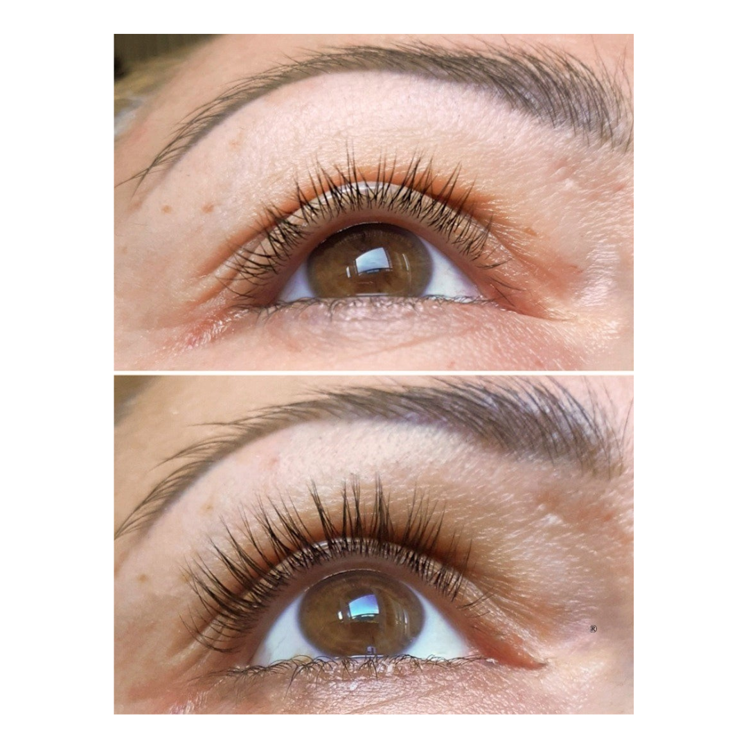 Lashora™ – Avanceret Peptidbaseret Vippeserum