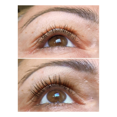 Lashora™ – Avanceret Peptidbaseret Vippeserum