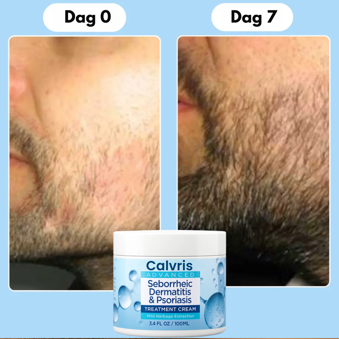 DermaBeard™ – Beroligende Skægcreme