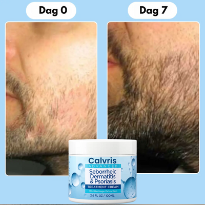 DermaBeard™ – Beroligende Skægcreme