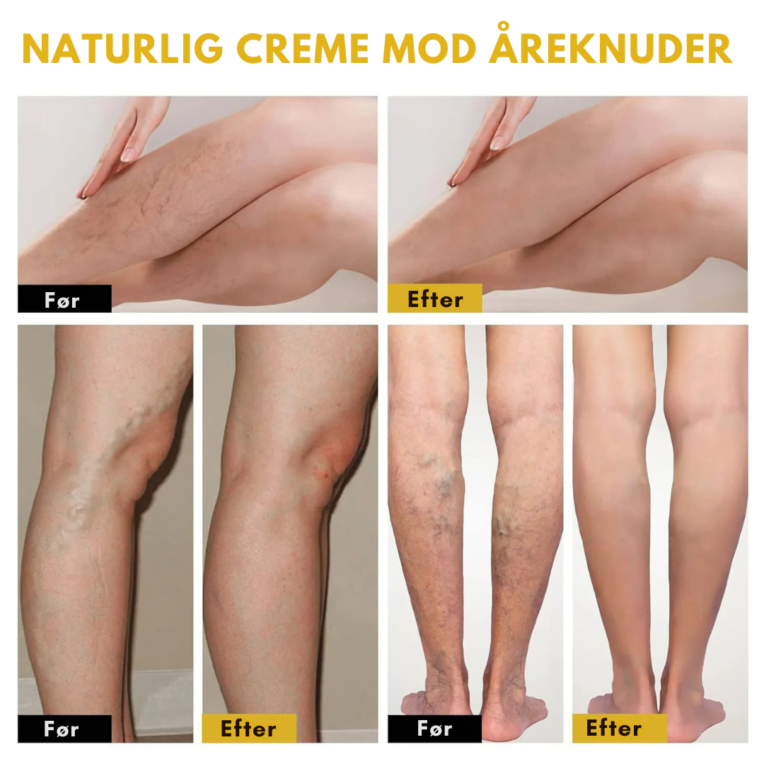 VeinoLux™ – Beroligende creme til ben og vener