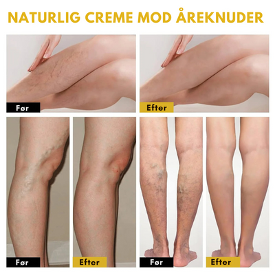 VeinoLux™ – Beroligende creme til ben og vener