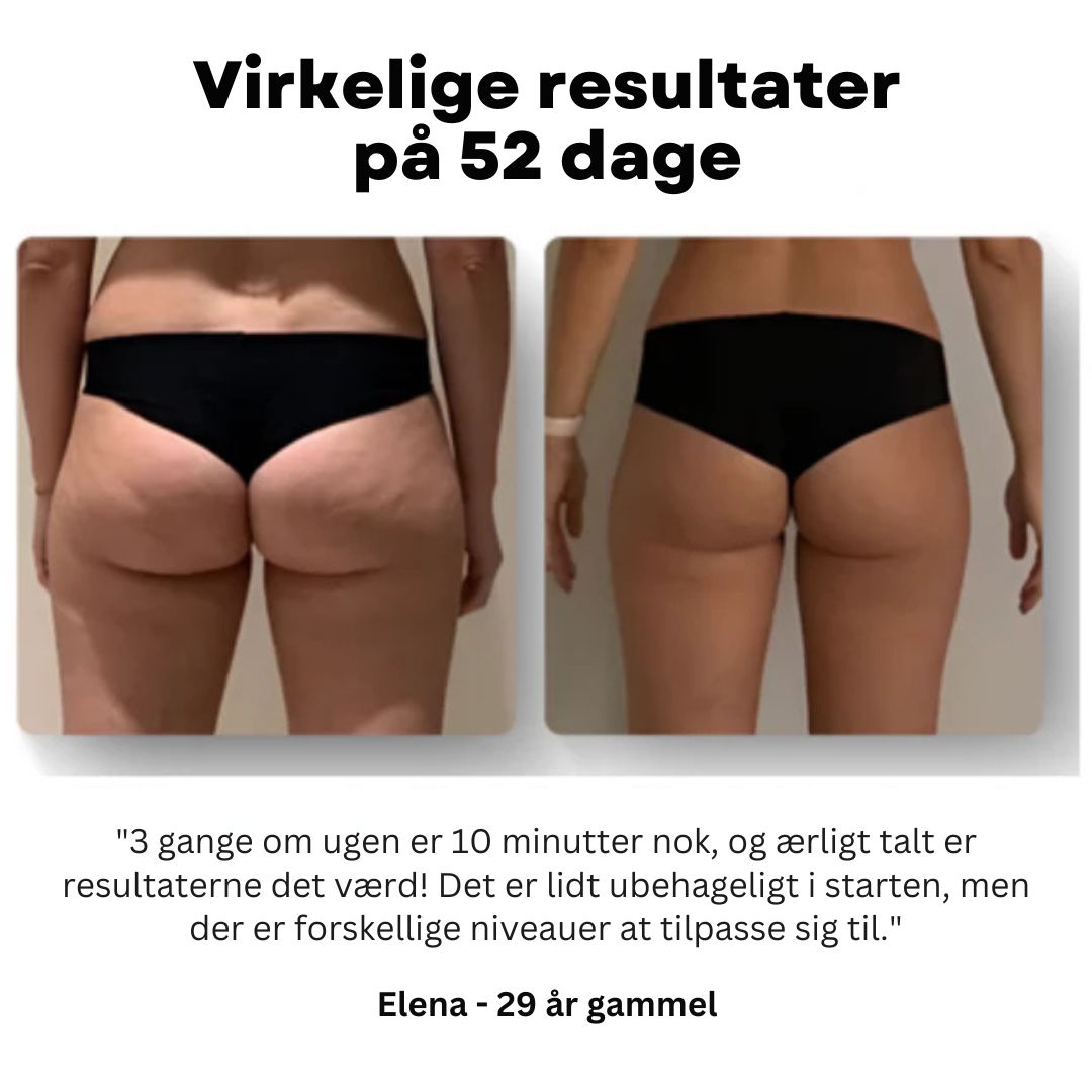 Cellexa™ - Cellulite Reduceringsmassager