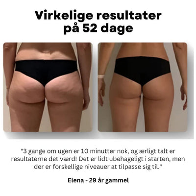 Cellexa™ - Cellulite Reduceringsmassager
