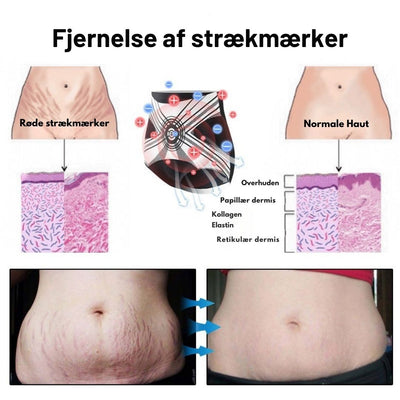 ThermoFit™ – Velværefremmende Formende Shorts
