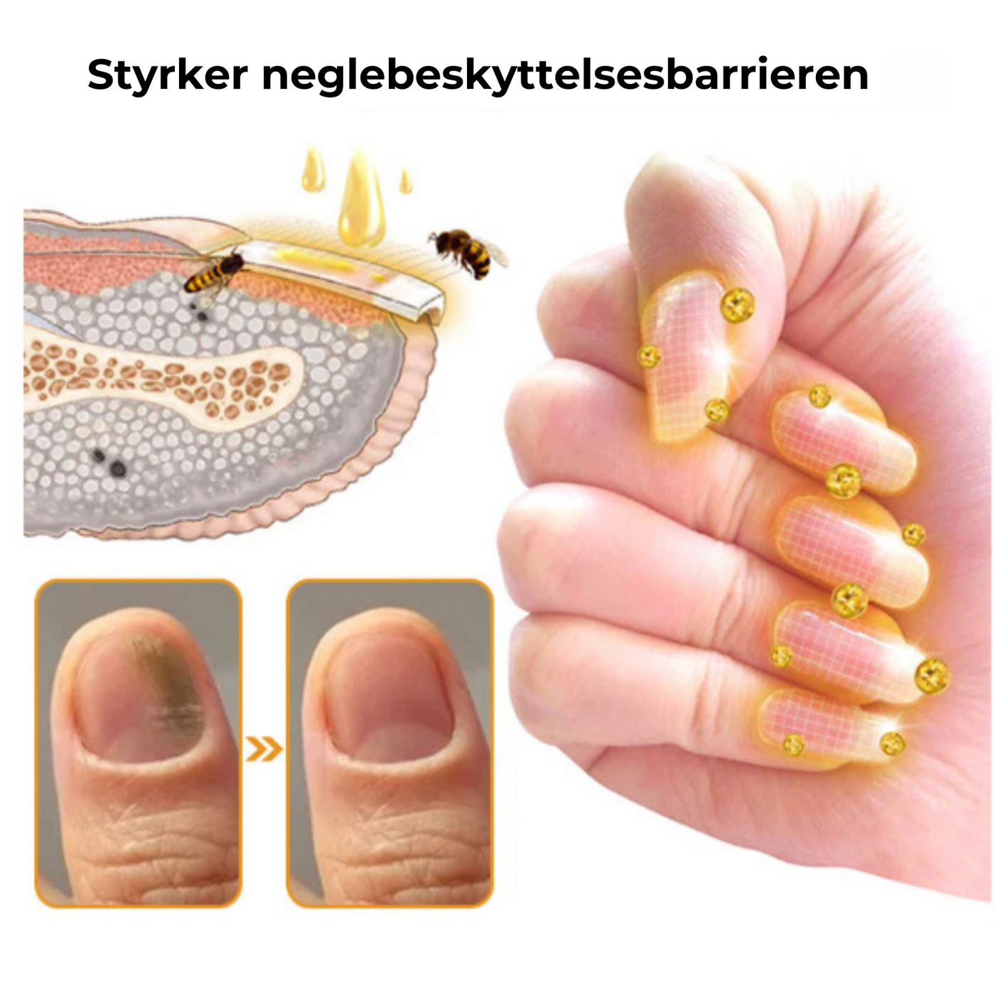 NailVive™ – Neglesvamp Behandlingsserum