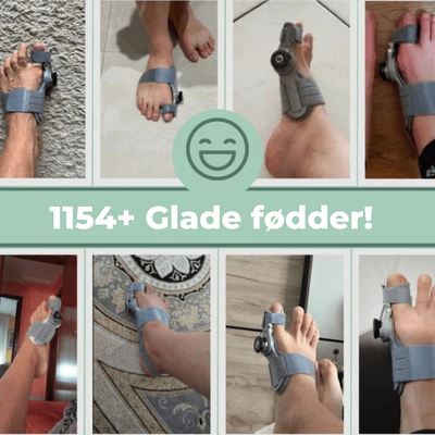 ToeComfort™ – Smertelindring og Korrektur for Hallux Valgus