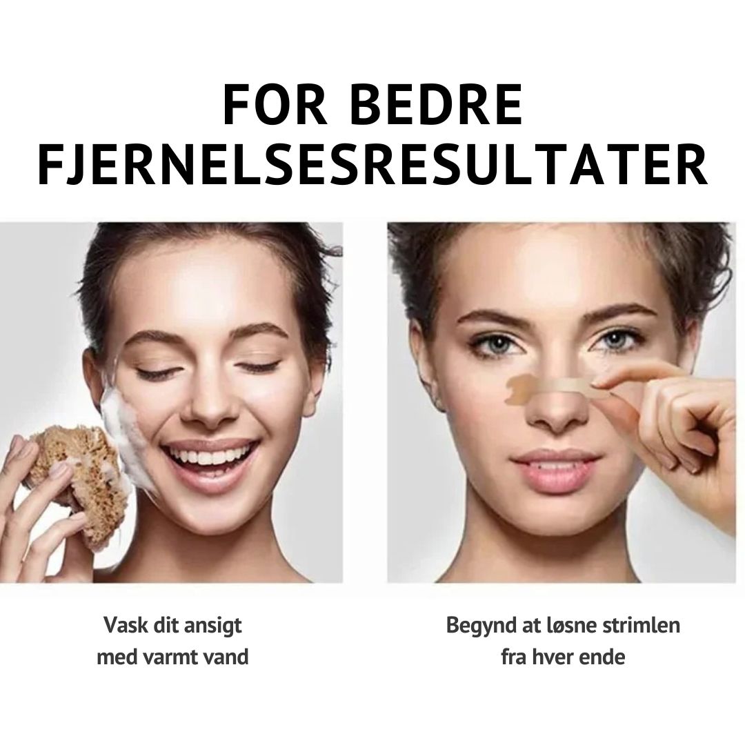 SleepClear™ – Anti-snorken Nasalstrips for Bedre Åndedræt og Søvn