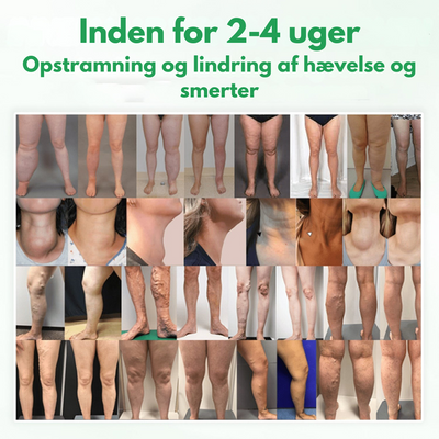 Lymphora™ – Naturlig lindring af hævelser