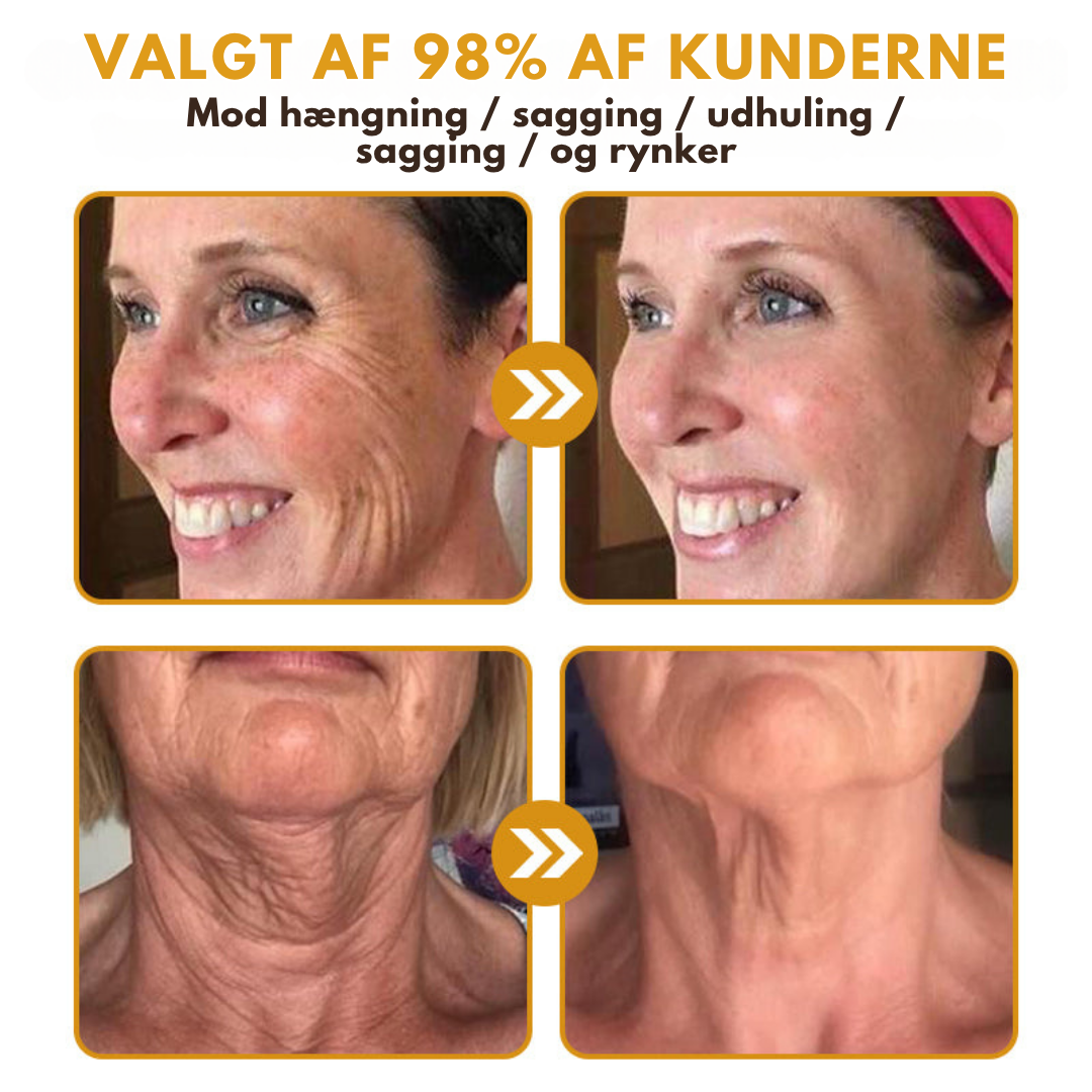 DermaLift™ – Avanceret Botox-Lignende Creme
