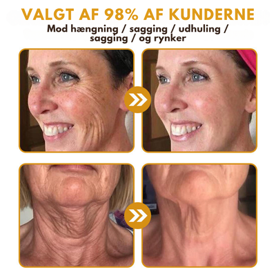 DermaLift™ – Avanceret Botox-Lignende Creme