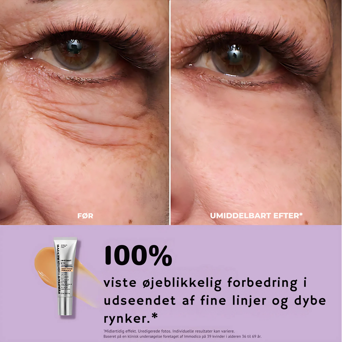 BrightLift™ - Øjeblikkelig Øjenløftning og Stramning