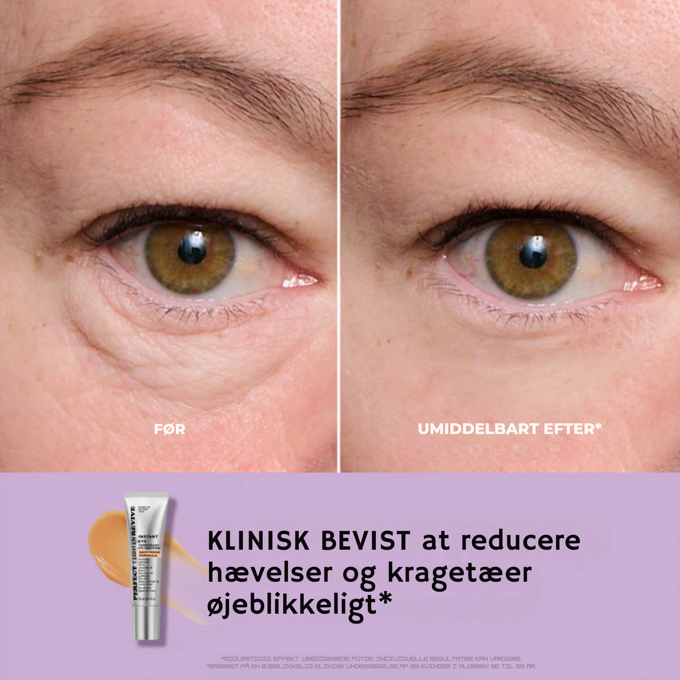 BrightLift™ - Øjeblikkelig Øjenløftning og Stramning