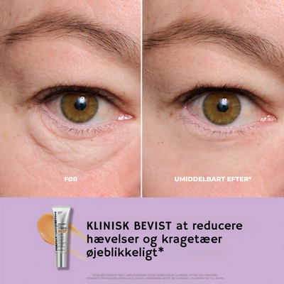 BrightLift™ - Øjeblikkelig Øjenløftning og Stramning