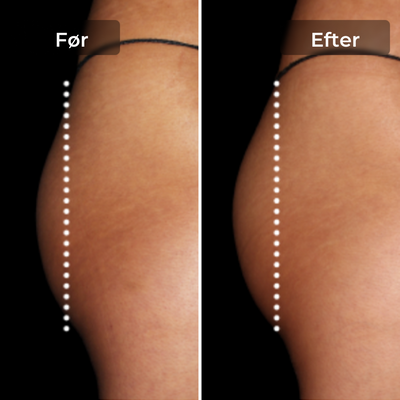 CoreLift™ – EMS-Shorts til Formning Og Toning