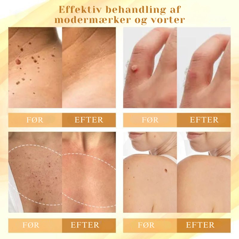 DermaVenom™ - Intensiv Hudreparationscreme