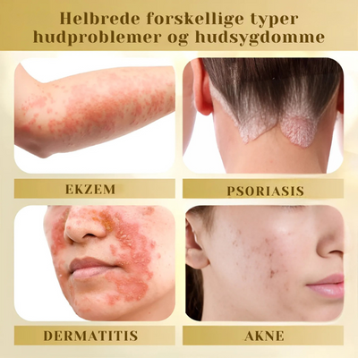 DermaVenom™ - Intensiv Hudreparationscreme
