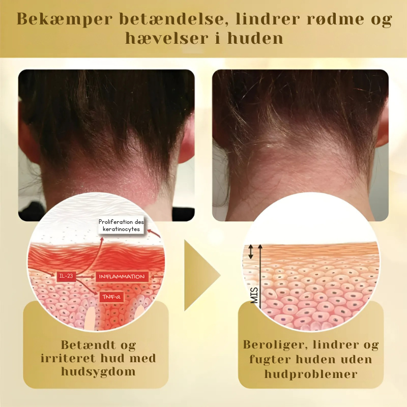 DermaVenom™ - Intensiv Hudreparationscreme