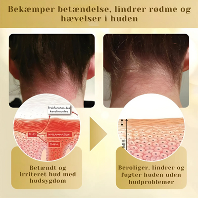 DermaVenom™ - Intensiv Hudreparationscreme