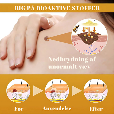 DermaVenom™ - Intensiv Hudreparationscreme