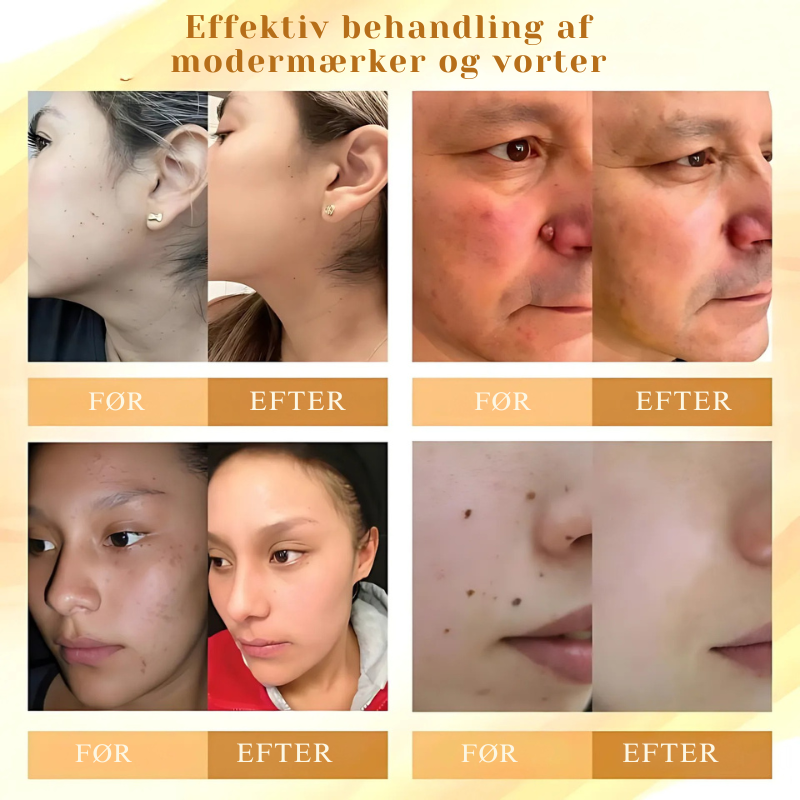 DermaVenom™ - Intensiv Hudreparationscreme