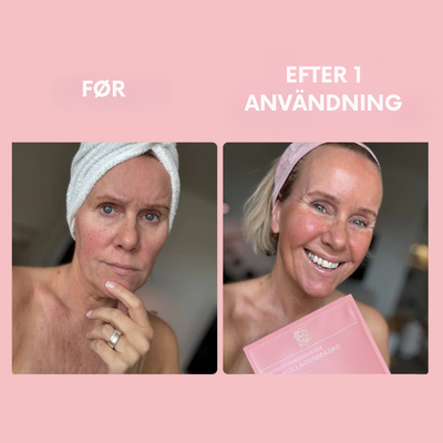 LumièreSkin™ – Dybt Fugtgivende Maske