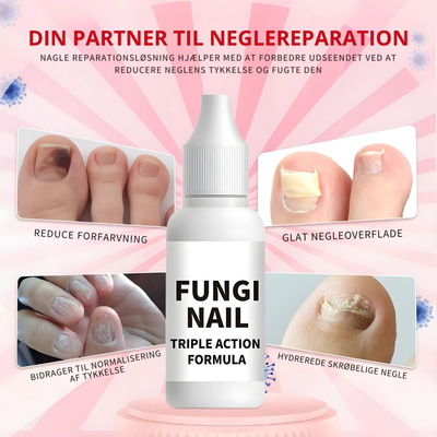 Nailfix™ – Ekstra Stærk Neglereparationsløsning