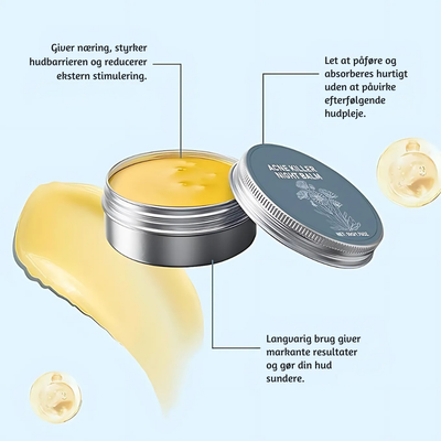 PuriZen™ – Skånsom Cremebalsam mod Akne & Bumser