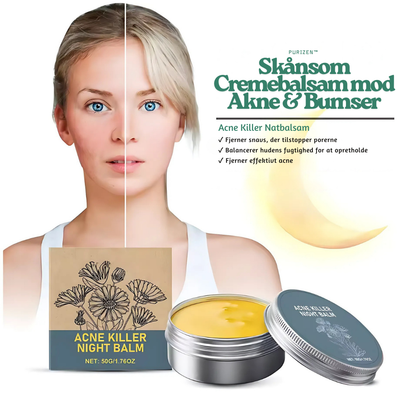 PuriZen™ – Skånsom Cremebalsam mod Akne & Bumser